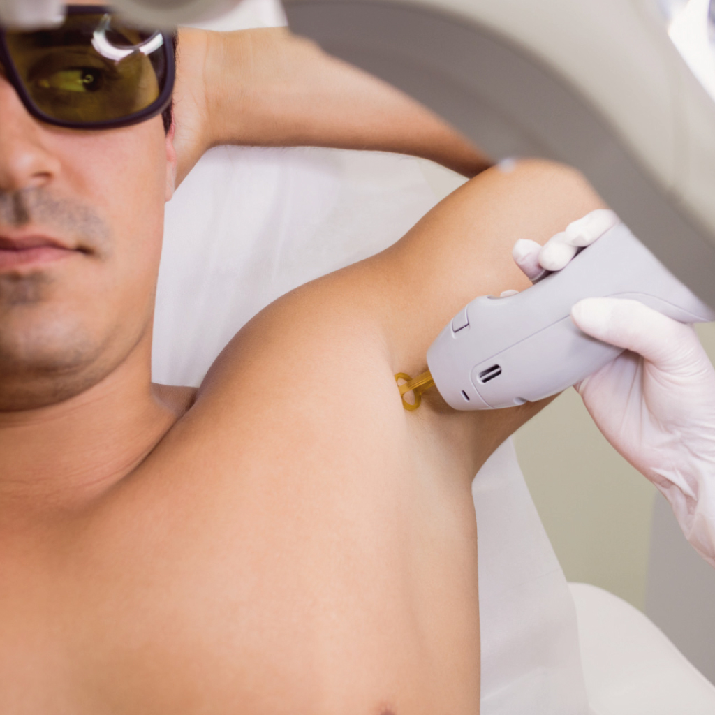 Depilação a Laser - Evo + Clinic Indaiatuba